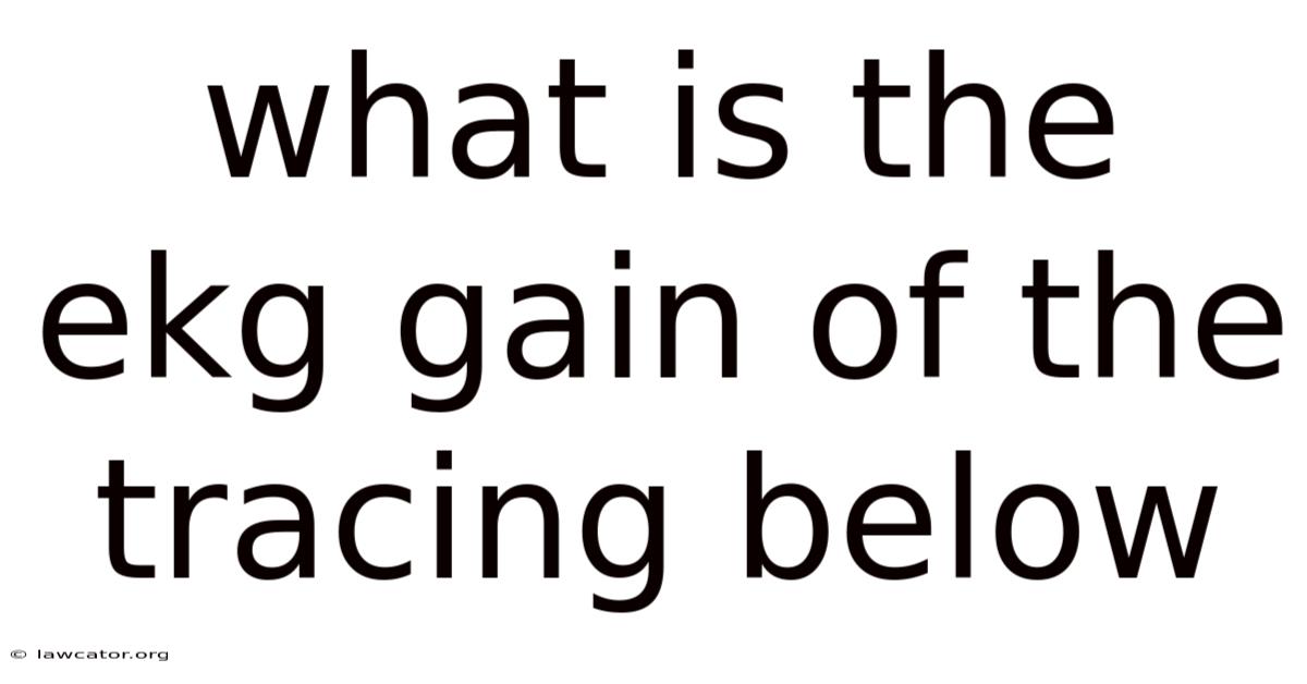 What Is The Ekg Gain Of The Tracing Below